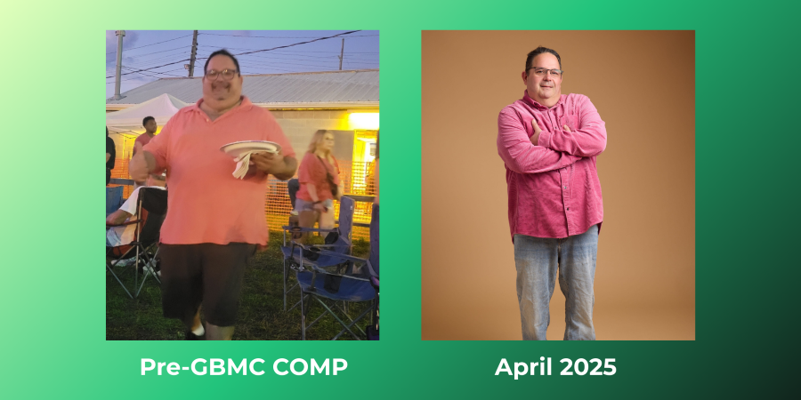 Patient Neal is shown before and after his weight-loss surgery