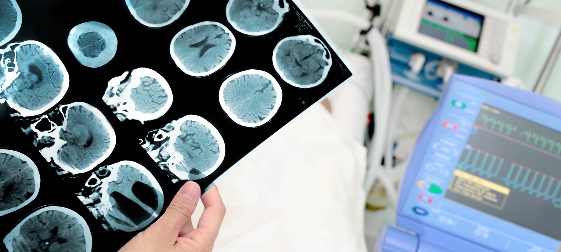 Close up image of brain imaging with medical machines behind.