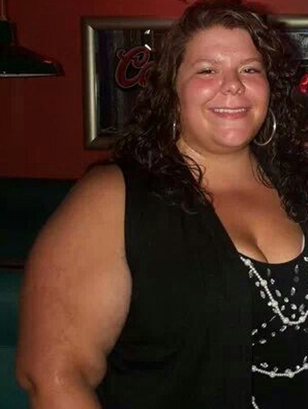 Erin Wilson before weightloss surgery